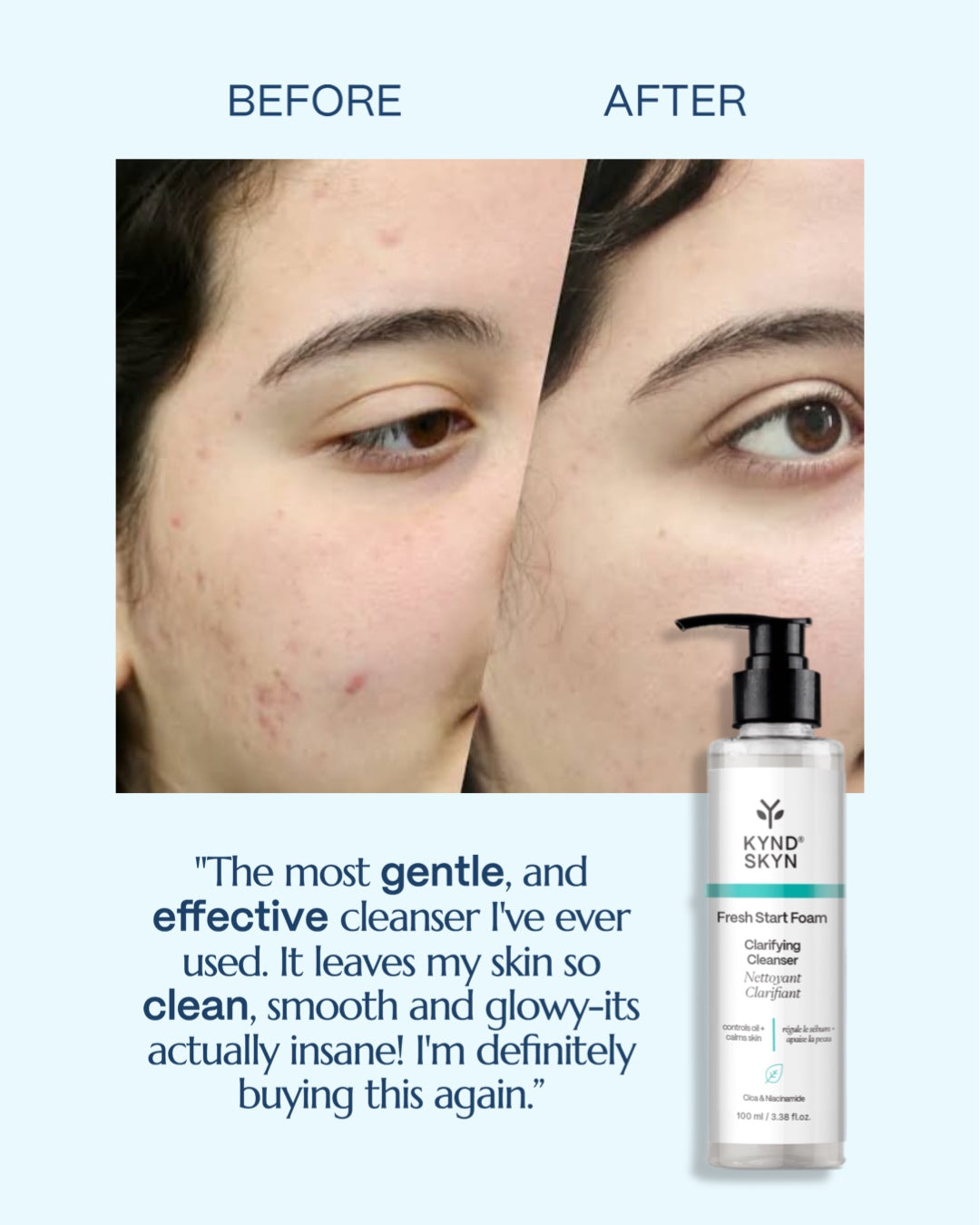 🍃 FRESH START FOAM — Clarifying Cleanser