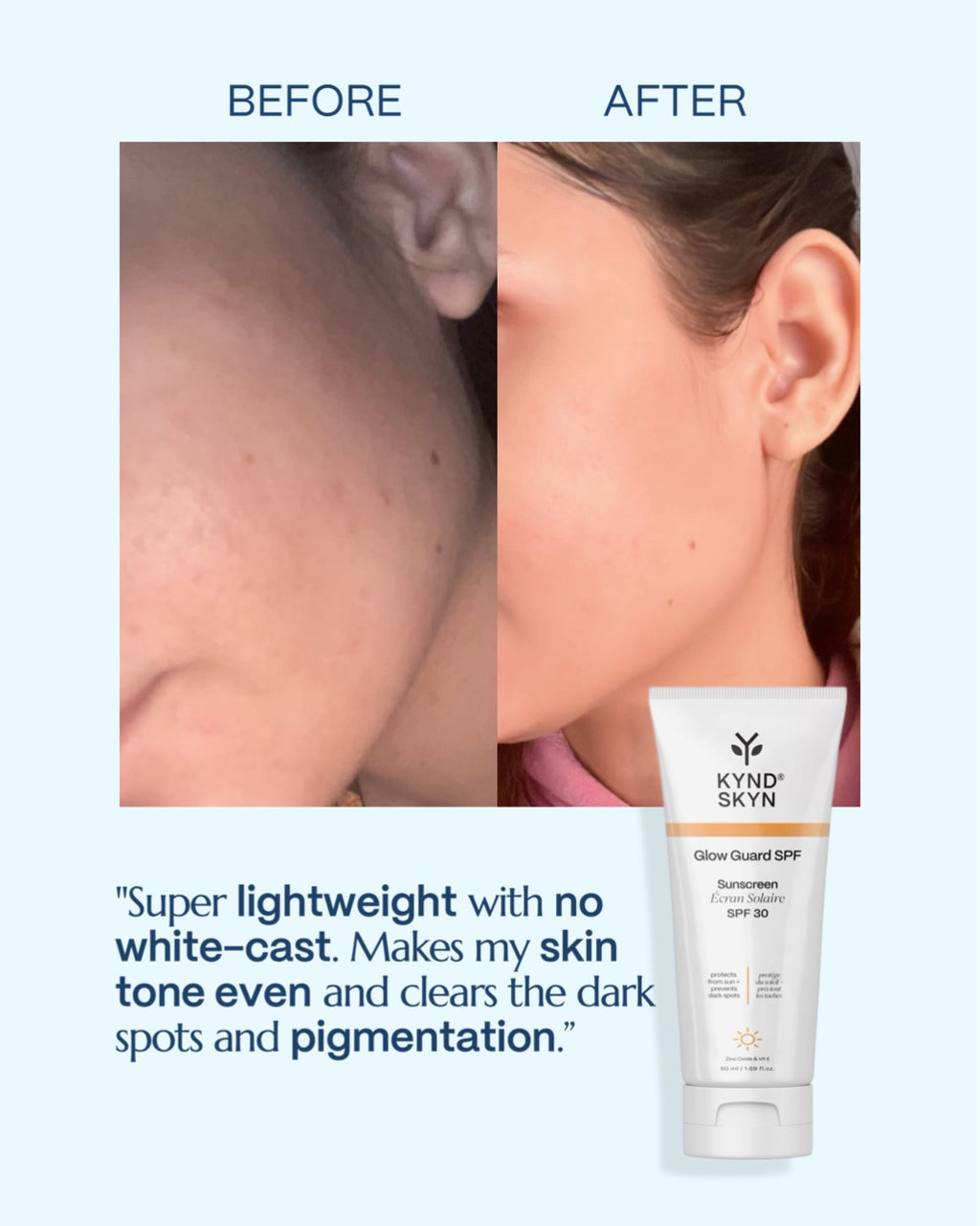 ☀️ GLOW GUARD — Daily Sunscreen SPF 30