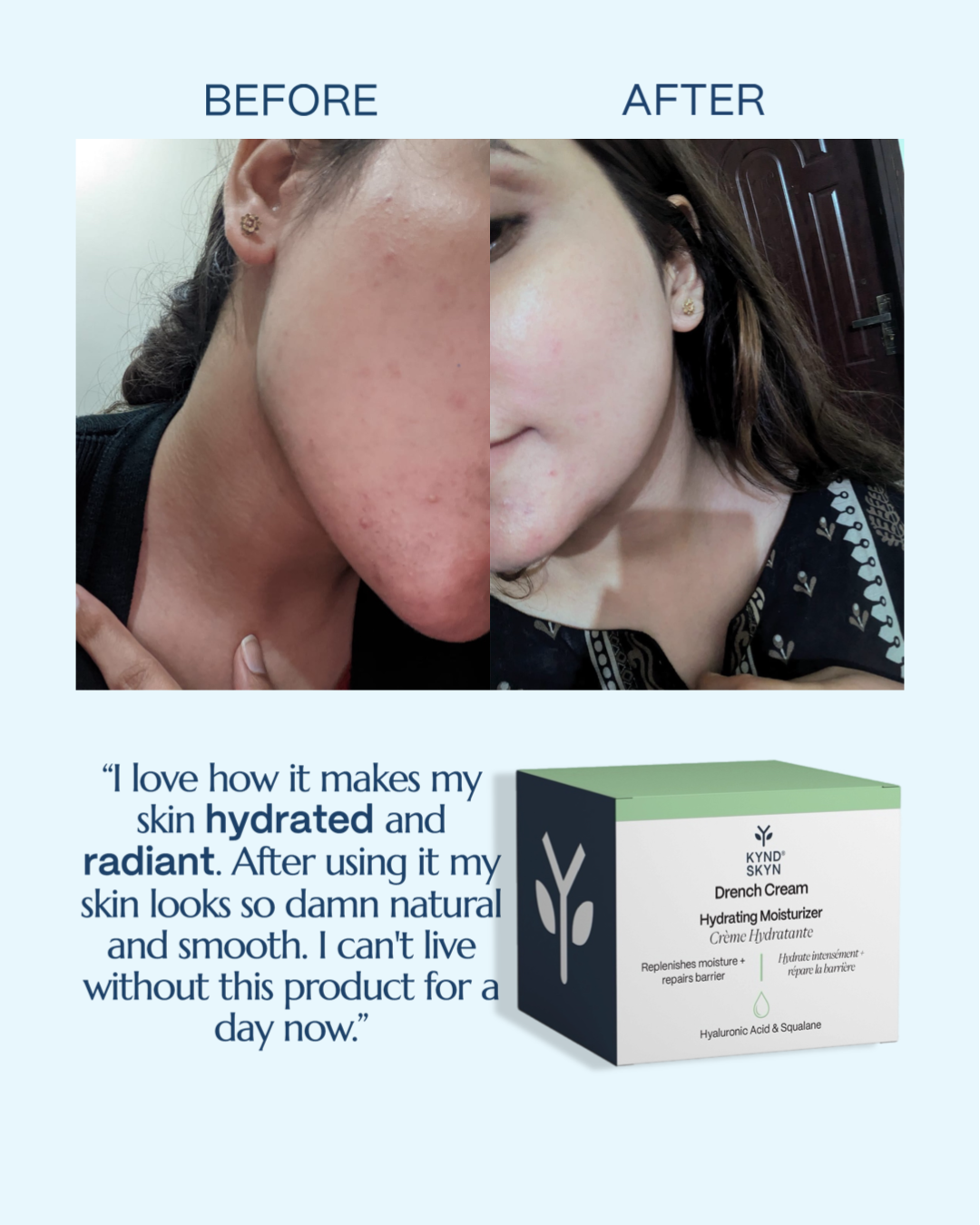 💧 DRENCH CREAM — Hydrating Moisturizer